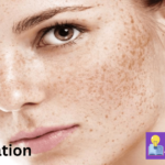 Pigmentation Treatment At Home In Hindi