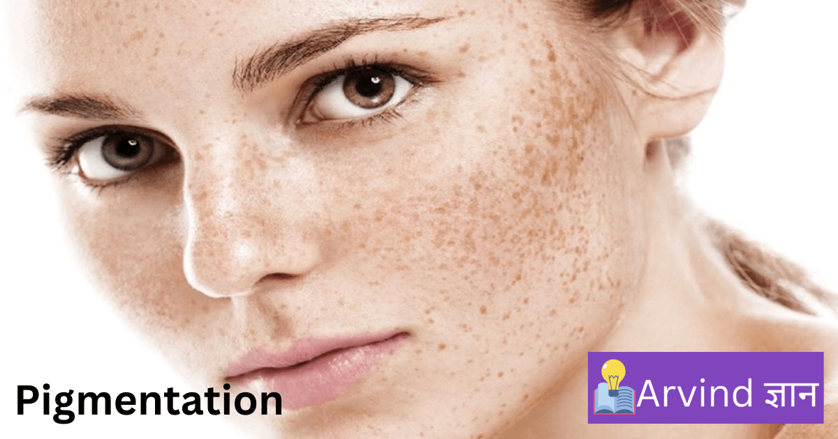 Pigmentation Treatment At Home In Hindi